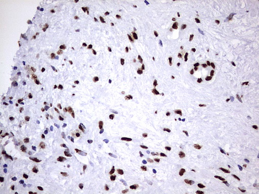 m06017 anti hnrpm hnrnpm mouse monoclonal antibody clone id oti4c9 ihc testing 7