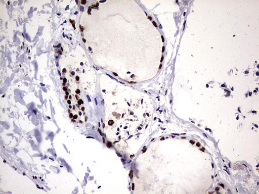 m06017 anti hnrpm hnrnpm mouse monoclonal antibody clone id oti4c9 ihc testing 8
