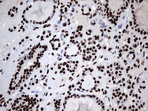 m06017 anti hnrpm hnrnpm mouse monoclonal antibody clone id oti4c9 ihc testing 9