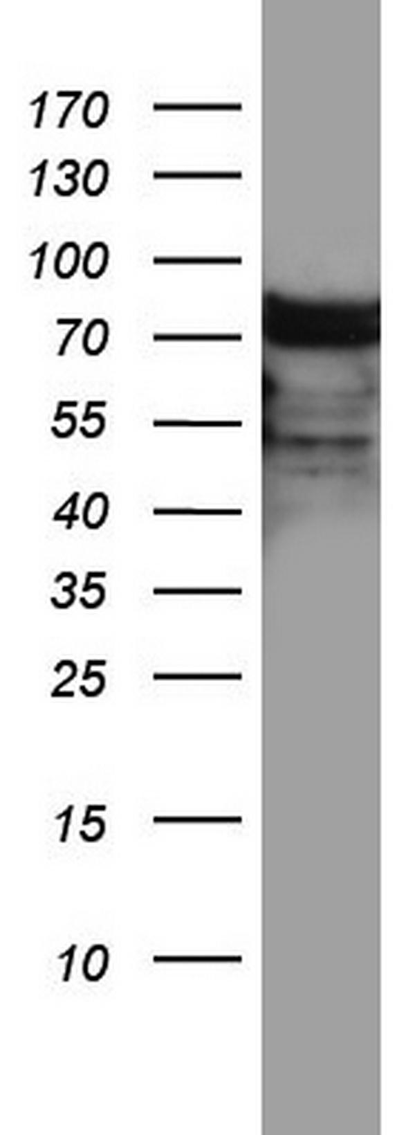 Western blot analysis of A549 cell lysate (35ug) by using anti-HNRNPM monoclonal antibody
