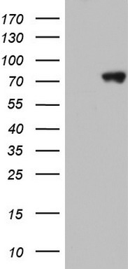 HEK293T cells were transfected with the pCMV6-ENTRY control (Left lane) or pCMV6-ENTRY HNRNPM (Right lane) cDNA for 48 hrs and lysed