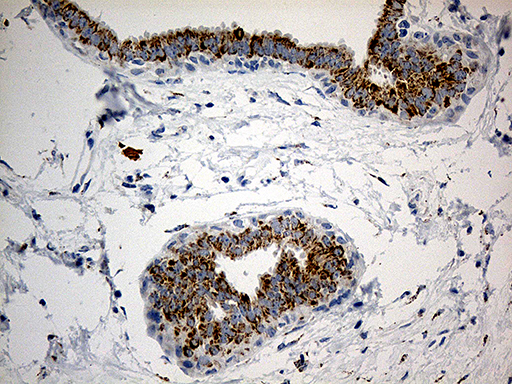 Immunohistochemical staining of paraffin-embedded Human breast tissue within the normal limits using anti-PYCR1 mouse monoclonal antibody