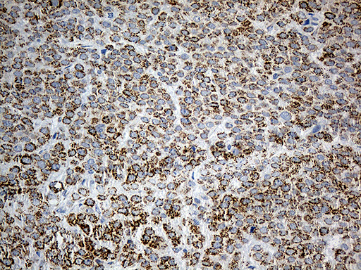 m06018 anti pycr1 mouse monoclonal antibody clone id oti4f2 ihc testing 4