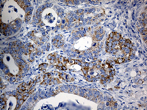 m06018 anti pycr1 mouse monoclonal antibody clone id oti4f2 ihc testing 5