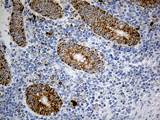 m06018 anti pycr1 mouse monoclonal antibody clone id oti4f2 ihc testing 6
