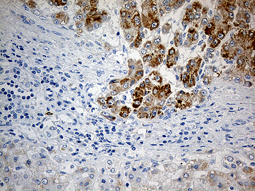 m06018 anti pycr1 mouse monoclonal antibody clone id oti4f2 ihc testing 7