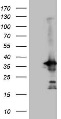 HEK293T cells were transfected with the pCMV6-ENTRY control (Left lane) or pCMV6-ENTRY PYCR1 (Right lane) cDNA for 48 hrs and lysed