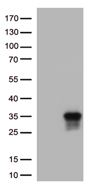HEK293T cells were transfected with the pCMV6-ENTRY control (Left lane) or pCMV6-ENTRY CD137L (Right lane) cDNA for 48 hrs and lysed