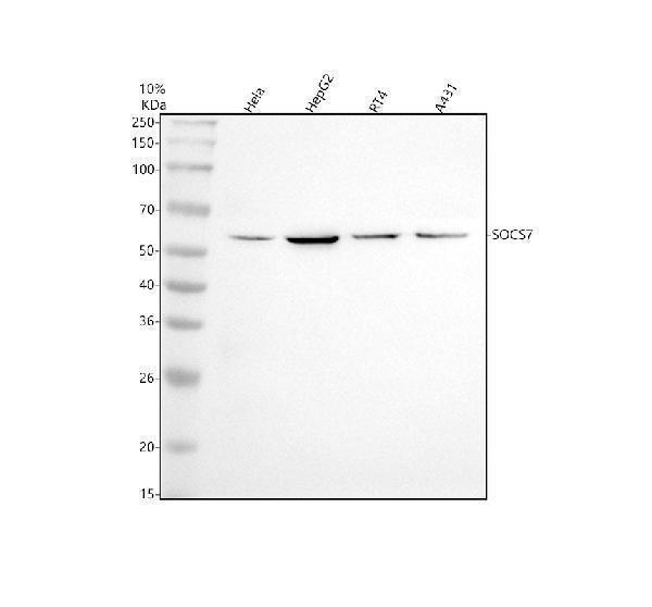  Western blot analysis of SOCS7 using anti-SOCS7 antibody (M06055)