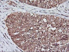 m06063 1 anti kv beta 1 kcnab1 mouse monoclonal antibody clone id oti7c7 ihc testing 2