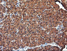 Immunohistochemical staining of paraffin-embedded Human pancreas tissue within the normal limits using anti-KCNAB1 mouse monoclonal antibody