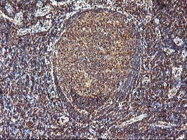 m06063 2 anti kv beta 1 kcnab1 mouse monoclonal antibody clone id oti4e7 ihc testing 5