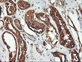 m06063 2 anti kv beta 1 kcnab1 mouse monoclonal antibody clone id oti4e7 ihc testing 6