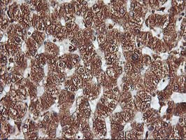 m06063 2 anti kv beta 1 kcnab1 mouse monoclonal antibody clone id oti4e7 ihc testing 7