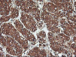 m06063 2 anti kv beta 1 kcnab1 mouse monoclonal antibody clone id oti4e7 ihc testing 8