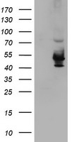 HEK293T cells were transfected with the pCMV6-ENTRY control (Left lane) or pCMV6-ENTRY KCNAB1 (Right lane) cDNA for 48 hrs and lysed