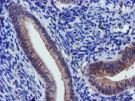Immunohistochemical staining of paraffin-embedded Human endometrium tissue within the normal limits using anti-KCNAB1 mouse monoclonal antibody