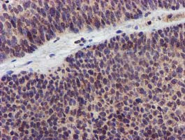 m06063 anti kv beta 1 kcnab1 mouse monoclonal antibody clone id oti7f12 ihc testing 4