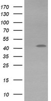 HEK293T cells were transfected with the pCMV6-ENTRY control (Left lane) or pCMV6-ENTRY KCNAB1 (Right lane) cDNA for 48 hrs and lysed