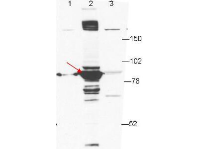 Anti-ESRP-1 by western blot shows detection of ESRP-1 seen in lane 2