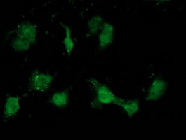 m06073 anti atp6v1b1 mouse monoclonal antibody clone id oti1h6 if testing 7