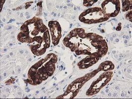 Immunohistochemical staining of paraffin-embedded Human Kidney tissue within the normal limits using anti-ATP6V1B1 mouse monoclonal antibody
