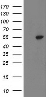HEK293T cells were transfected with the pCMV6-ENTRY control (Left lane) or pCMV6-ENTRY ATP6V1B1 (Right lane) cDNA for 48 hrs and lysed