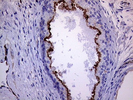 m06081 anti melanophilin mlph mouse monoclonal antibody clone id oti6e3 ihc testing 4