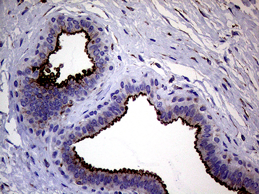 m06081 anti melanophilin mlph mouse monoclonal antibody clone id oti6e3 ihc testing 5