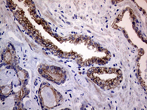 m06081 anti melanophilin mlph mouse monoclonal antibody clone id oti6e3 ihc testing 6