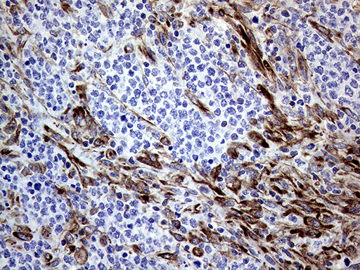 m06081 anti melanophilin mlph mouse monoclonal antibody clone id oti6e3 ihc testing 7