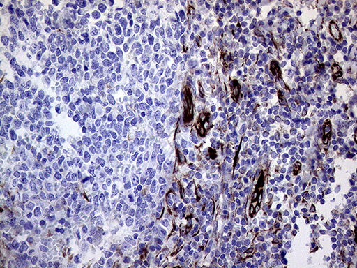 m06081 anti melanophilin mlph mouse monoclonal antibody clone id oti6e3 ihc testing 8