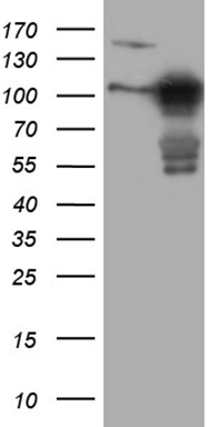 HEK293T cells were transfected with the pCMV6-ENTRY control (Left lane) or pCMV6-ENTRY MLPH (Right lane) cDNA for 48 hrs and lysed