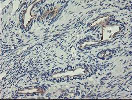 Immunohistochemical staining of paraffin-embedded Human Ovary tissue within the normal limits using anti-CLEC4E mouse monoclonal antibody