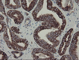 m06084 1 anti clec4e mouse monoclonal antibody clone id oti2a8 ihc testing 6