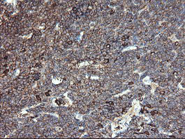 m06084 1 anti clec4e mouse monoclonal antibody clone id oti2a8 ihc testing 7