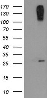 HEK293T cells were transfected with the pCMV6-ENTRY control (Left lane) or pCMV6-ENTRY CLEC4E (Right lane) cDNA for 48 hrs and lysed