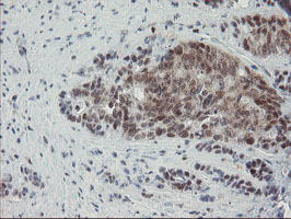 m06089 anti nyren18 nub1 mouse monoclonal antibody clone id oti4h2 ihc testing 4