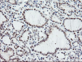 m06089 anti nyren18 nub1 mouse monoclonal antibody clone id oti4h2 ihc testing 5