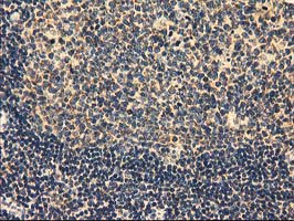 Immunohistochemical staining of paraffin-embedded Human lymph node tissue within the normal limits using anti-MMAB mouse monoclonal antibody