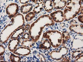 m06106 anti mmab mouse monoclonal antibody clone id oti2g5 ihc testing 4