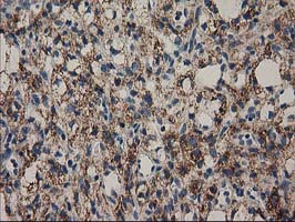 m06106 anti mmab mouse monoclonal antibody clone id oti2g5 ihc testing 5