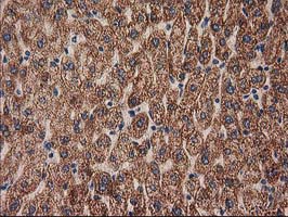 m06106 anti mmab mouse monoclonal antibody clone id oti2g5 ihc testing 6