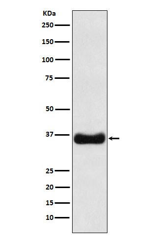 Western blot analysis of Olig1 expression in MOLT4 cell lysate