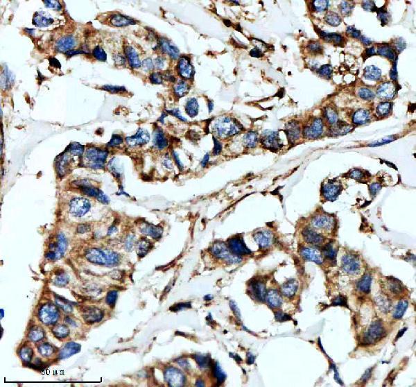 IHC analysis of GSTK1 using anti-GSTK1 antibody (M06112-1)