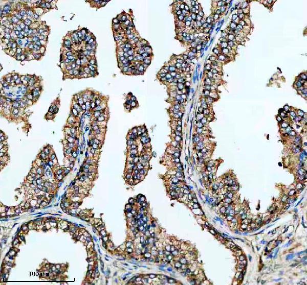 IHC analysis of GSTK1 using anti-GSTK1 antibody (M06112-1)