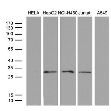 Western blot analysis of extracts (35ug) from 5 different cell lines by using anti-PSMD9 monoclonal antibody (1:500)