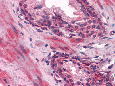 Immunohistochemistry analysis of paraffin-embedded human Prostate tissues with AEC staining using Lipocalin-1 Monoclonal Antibody