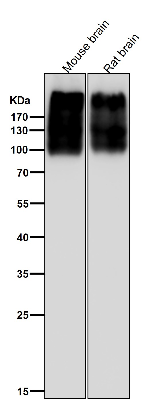 All lanes use the Antibody at 1:1W dilution for 1 hour at room temperature