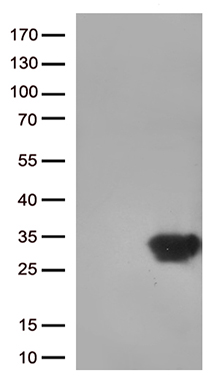 HEK293T cells were transfected with the pCMV6-ENTRY control (Left lane) or pCMV6-ENTRY DUSP3 (Right lane) cDNA for 48 hrs and lysed